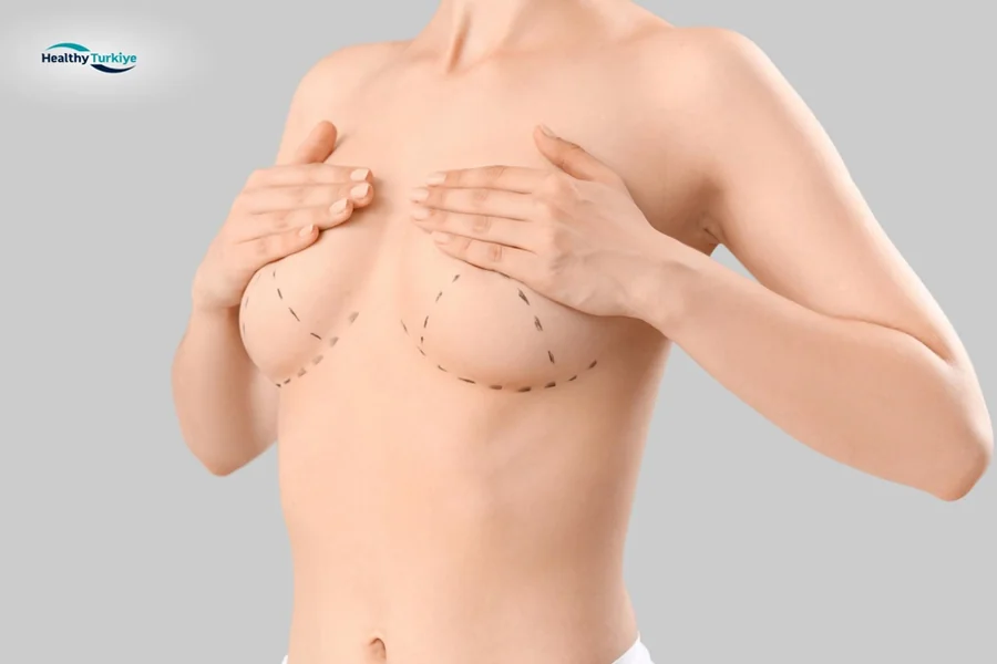 Breast Lift Turkey
